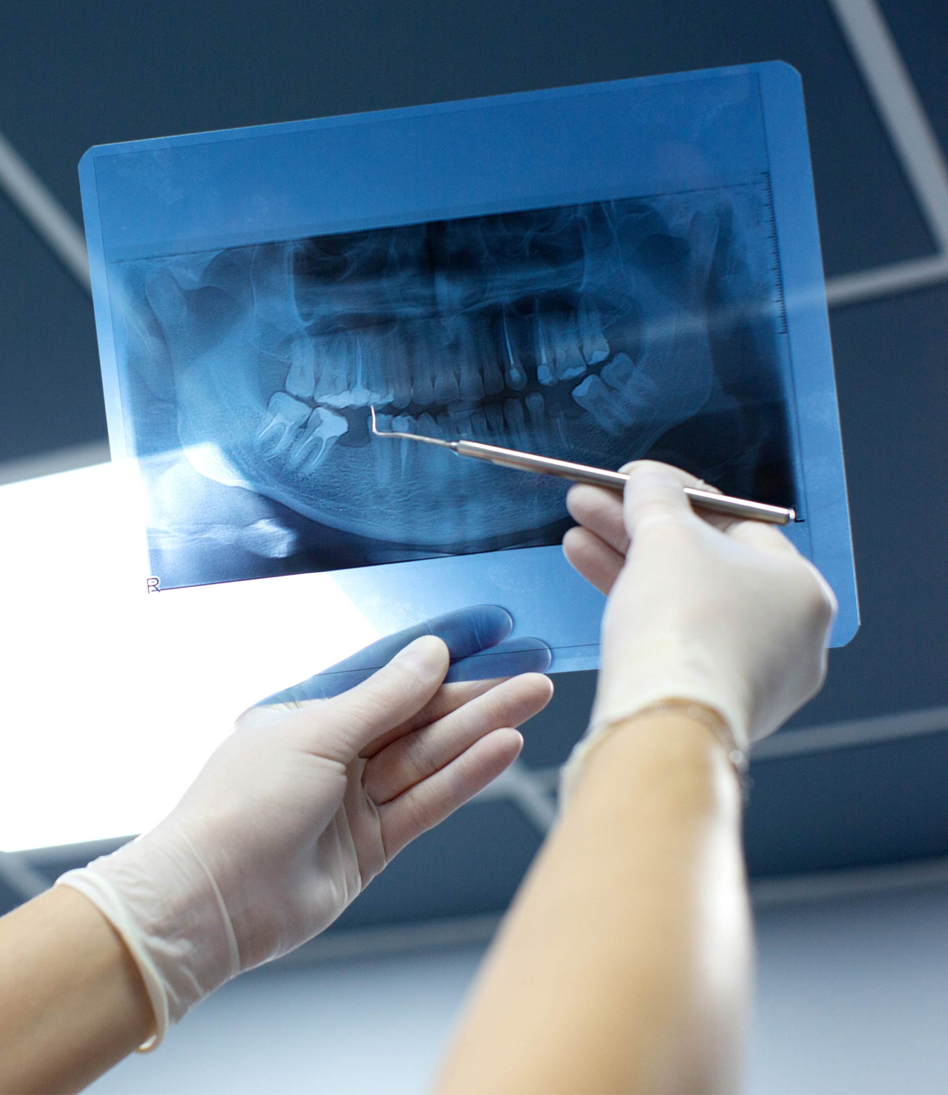 Dental radiography